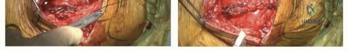 Clinical Image