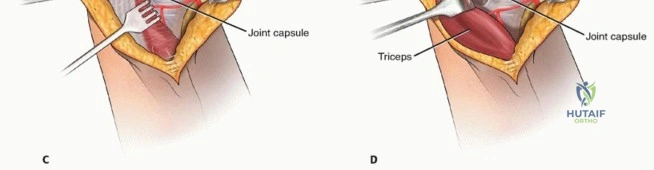 Clinical Image