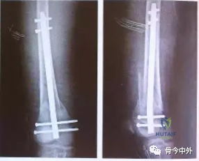 Clinical Image
