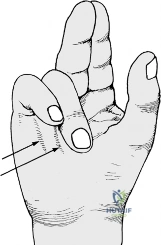 Clinical Image
