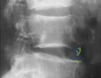 Clinical Image