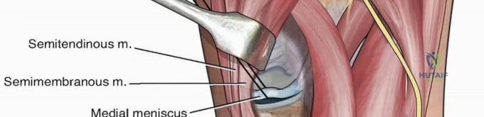 Clinical Image