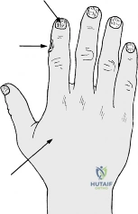 Clinical Image