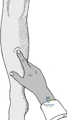 Clinical Image