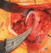Clinical Image