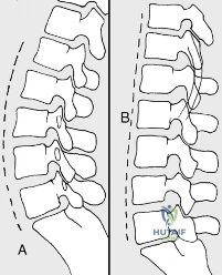 Clinical Image