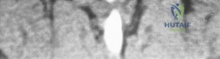 Clinical Image