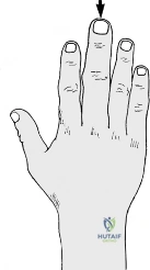 Clinical Image