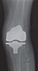 Clinical Image