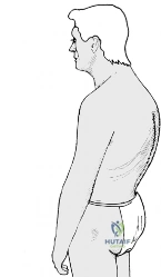 Clinical Image