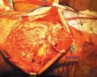 Clinical Image