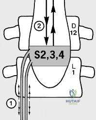 Clinical Image