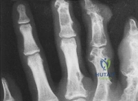 Clinical Image