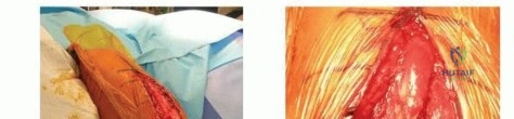 Clinical Image