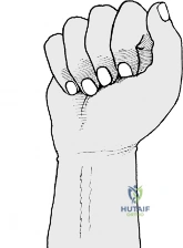 Clinical Image