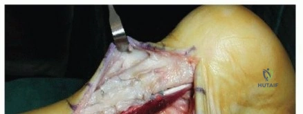 Clinical Image