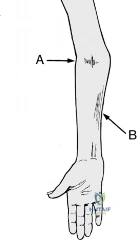 Clinical Image