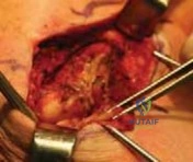 Clinical Image