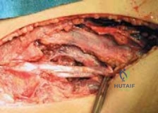 Clinical Image