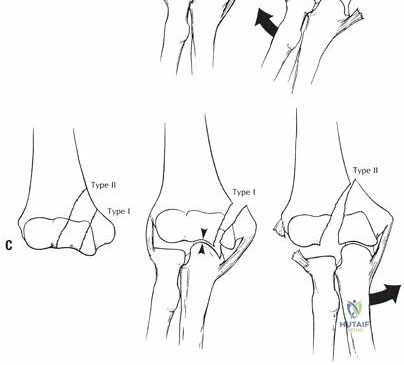 Clinical Image