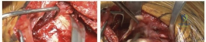 Clinical Image