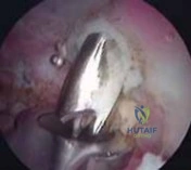 Clinical Image