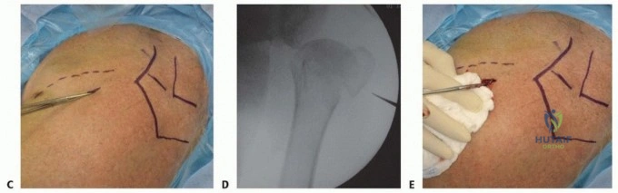 Clinical Image