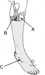 Clinical Image