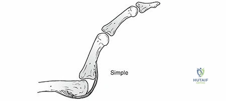 Clinical Image