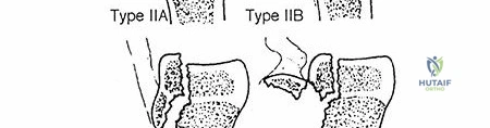 Clinical Image