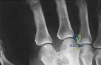 Clinical Image