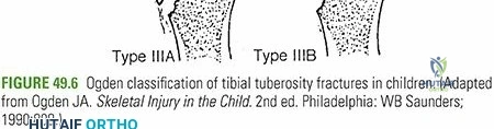 Clinical Image