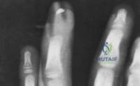 Clinical Image