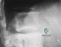 Clinical Image