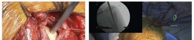 Clinical Image
