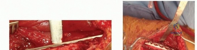 Clinical Image