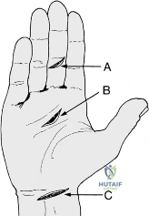 Clinical Image