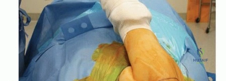 Clinical Image