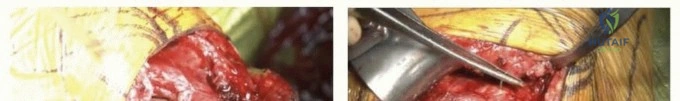 Clinical Image