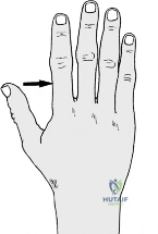 Clinical Image