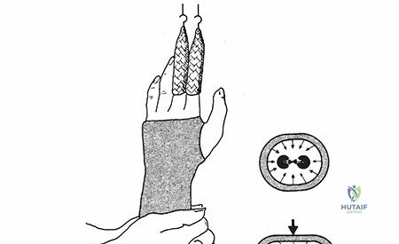 Clinical Image