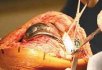 Clinical Image