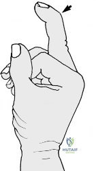 Clinical Image