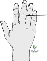 Clinical Image