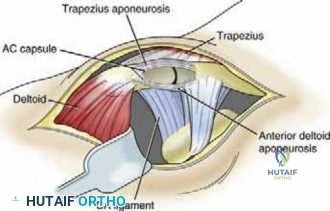 Clinical Image