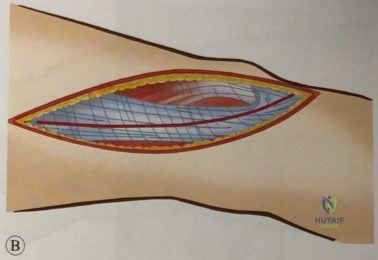 Clinical Image