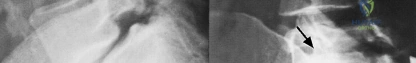 Clinical Image