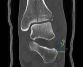 Clinical Image