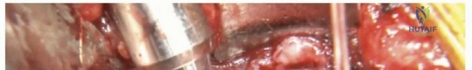 Clinical Image