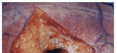 Clinical Image